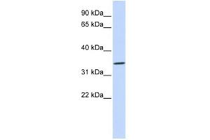 WB Suggested Anti-RHCE Antibody Titration:  0. (RHCE Antikörper  (N-Term))