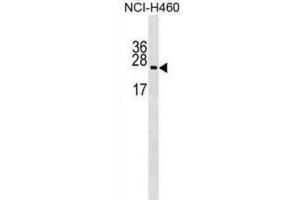Western Blotting (WB) image for anti-Ribosomal Protein L10a (RPL10A) antibody (ABIN2999207) (RPL10A Antikörper)