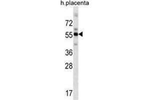 ZBTB8B Antibody (C-term) (AP54617PU-N ) western blot analysis in human placenta tissue lysates (35 µg/lane). (ZBTB8B Antikörper  (C-Term))
