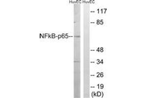 Western blot analysis of extracts from HuvEc cells, treated with EPO 20U/ml 15', using NF-kappaB p65 (Ab-281) Antibody. (NF-kB p65 Antikörper  (AA 247-296))