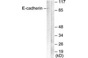 Western Blotting (WB) image for anti-Cadherin 1, Type 1, E-Cadherin (Epithelial) (CDH1) (AA 1-50) antibody (ABIN1533229)