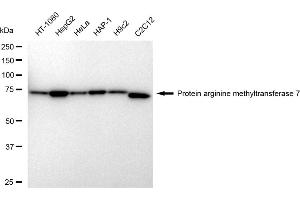 anti-Protein Arginine Methyltransferase 7 (PRMT7) antibody