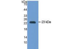 Western blot analysis of recombinant Mouse VCAM1.