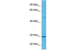 Host:  Rabbit  Target Name:  BDNF  Sample Tissue:  Human Ovary Tumor  Antibody Dilution:  1ug/ml (BDNF Antikörper  (Middle Region))