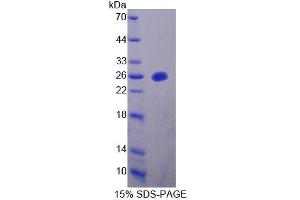 SDS-PAGE analysis of Mouse MTUS1 Protein.