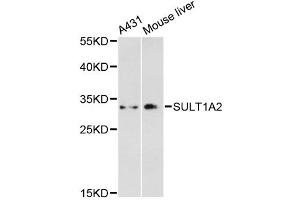 Western blot analysis of extracts of various cell lines, using SULT1A2 antibody. (SULT1A2 Antikörper)