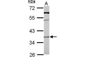 Western Blotting (WB) image for anti-Transmembrane Protein 59 (TMEM59) antibody (ABIN2855840)