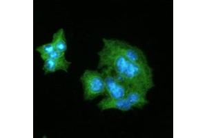 ICC/IF analysis of CRP in HepG2 cells line, stained with DAPI (Blue) for nucleus staining and monoclonal anti-human CRP antibody (1:100) with goat anti-mouse IgG-Alexa fluor 488 conjugate (Green). (CRP Antikörper  (AA 19-224))