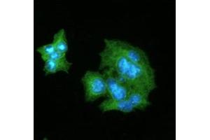 ICC/IF analysis of CRP in HepG2 cells line, stained with DAPI (Blue) for nucleus staining and monoclonal anti-human CRP antibody (1:100) with goat anti-mouse IgG-Alexa fluor 488 conjugate (Green). (CRP Antikörper)