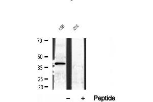 Western blot analysis of extracts of A2780 cells, using NDE1 antibody. (NDE1 Antikörper  (N-Term))