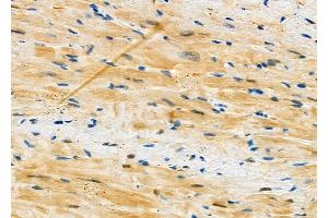 ABIN6263136 and ABIN6273134 at 1/100 staining Mouse heart tissue by IHC-P. (CMA1 Antikörper  (C-Term))