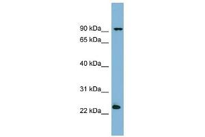 VPS29 antibody used at 1 ug/ml to detect target protein. (VPS29 Antikörper)