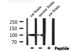Western blot analysis of extracts from rat brain, mouse brain, using CHSY3 Antibody. (CHSY3 Antikörper  (N-Term))