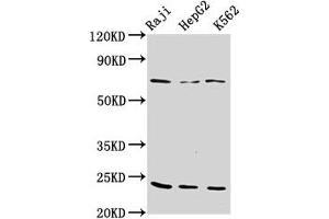 Western Blot Positive WB detected in: Raji whole cell lysate, HepG2 whole cell lysate, K562 whole cell lysate All lanes: PSMB9 antibody at 10 μg/mL Secondary Goat polyclonal to rabbit IgG at 1/50000 dilution Predicted band size: 24, 23 kDa Observed band size: 24 kDa (PSMB9 Antikörper  (AA 21-219))