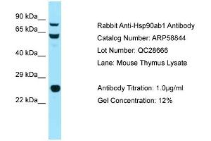 Western Blotting (WB) image for anti-Heat Shock Protein 90kDa alpha (Cytosolic), Class B Member 1 (HSP90AB1) (N-Term) antibody (ABIN2787849) (HSP90AB1 Antikörper  (N-Term))