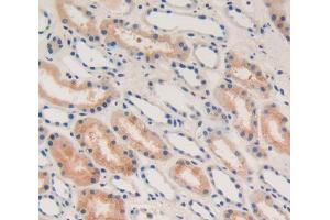 Used in DAB staining on fromalin fixed paraffin- embedded Kidney tissue (IFNA Antikörper  (AA 24-189))
