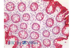 ABIN5539708 (5µg/ml) staining of paraffin embedded Human Colon. (KRT20 Antikörper  (AA 48-60))