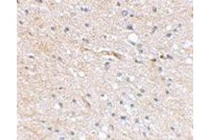 Immunohistochemical staining of human brain tissue using FBXL20 polyclonal antibody  at 2. (FBXL20 Antikörper  (N-Term))