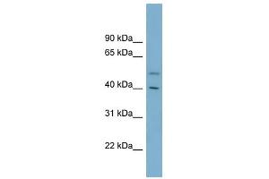 B4GALT2 antibody used at 1 ug/ml to detect target protein. (B4GALT2 Antikörper  (Middle Region))