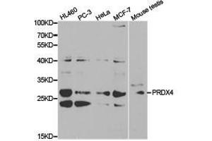 Western Blotting (WB) image for anti-Peroxiredoxin 4 (PRDX4) antibody (ABIN1874258) (Peroxiredoxin 4 Antikörper)