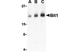 Western Blotting (WB) image for anti-Peptidyl-tRNA Hydrolase 2 (PTRH2) (Middle Region) antibody (ABIN1030890) (PTRH2 Antikörper  (Middle Region))