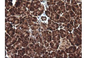Image no. 2 for anti-D-Dopachrome Tautomerase (DDT) antibody (ABIN1497795)