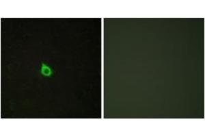 Immunofluorescence analysis of HepG2 cells, using RECK Antibody.