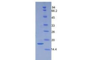 SDS-PAGE analysis of Mouse Periostin Protein. (Periostin Protein (POSTN))