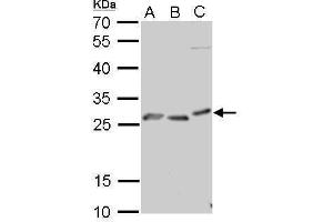 WB Image PRP antibody detects PRNP protein by Western blot analysis. (PRNP Antikörper)