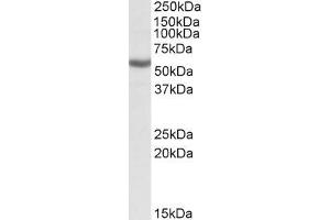 ABIN571184 (0. (ALDH3B1 Antikörper  (Internal Region))