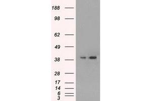 HEK293T cells were transfected with the pCMV6-ENTRY control (Left lane) or pCMV6-ENTRY MAPK1 (Right lane) cDNA for 48 hrs and lysed. (ERK2 Antikörper)