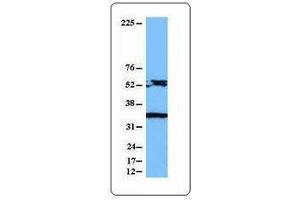 Western Blotting (WB) image for anti-Caspase 8 (CASP8) antibody (ABIN2666061) (Caspase 8 Antikörper)