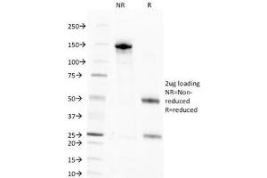 SDS-PAGE Analysis of Purified, BSA-Free Nuclear Marker Antibody (clone NM106). (Nuclear Marker Antikörper)