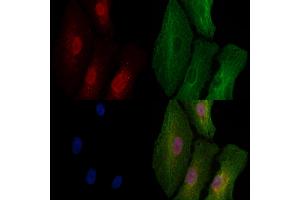 ABIN6257072 and ABIN6273592 staining  cells by IF/ICC. (CPEB1 Antikörper  (Internal Region))