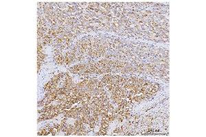IHC analysis of GADD34/PPP1R15A using anti-GADD34/PPP1R15A antibody (ABIN7602074).