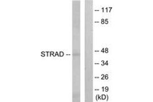 Western blot analysis of extracts from HepG2 cells, using STRAD Antibody. (STRADA Antikörper  (AA 11-60))