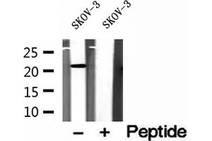Western blot analysis of extracts of SKOV-3 cells, using ICT1 antibody. (ICT1 Antikörper)