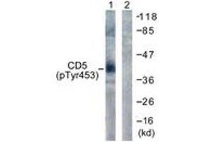 Western blot analysis of extracts from 293 cells treated with PMA 125ng/ml 30' , using CD5 (Phospho-Tyr453) Antibody. (CD5 Antikörper  (pTyr453))