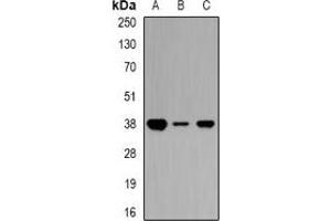 Western blot analysis of Ciao 1 expression in Jurkat (A), mouse kidney (B), rat heart (C) whole cell lysates.