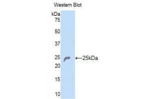 Western Blotting (WB) image for anti-Collagen, Type VI, alpha 1 (COL6A1) (AA 816-1002) antibody (ABIN1175580)