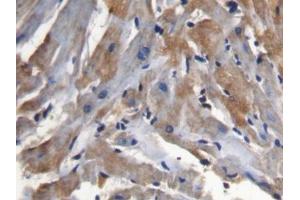 IHC-P analysis of Mouse Cardiac Muscle Tissue, with DAB staining. (SFRP1 Antikörper  (AA 32-314))