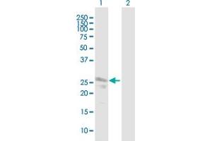 Western Blot analysis of LRRK1 expression in transfected 293T cell line by LRRK1 MaxPab polyclonal antibody. (LRRK1 Antikörper  (AA 1-261))