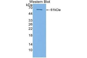 Western blot analysis of the recombinant protein. (TGFBR3 Antikörper  (AA 469-724))