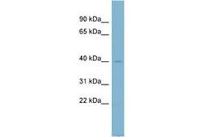 Image no. 1 for anti-NADH Dehydrogenase (Ubiquinone) 1 alpha Subcomplex, 9, 39kDa (NDUFA9) (AA 35-84) antibody (ABIN6742145) (NDUFA9 Antikörper  (AA 35-84))