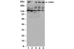 Western blot testing of ATM antibody and Lane 1:  HeLa;  2: SMMC-7721;  3: U87;  4: A549;  5: MCF-7 (ATM Antikörper  (N-Term))