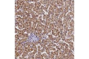 Immunohistochemical staining of human liver with LRRIQ1 polyclonal antibody  shows strong cytoplasmic positivity in hepatocytes. (LRRIQ1 Antikörper)