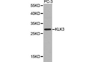 Western blot analysis of extracts of PC-3 cell lines, using KLK3 antibody. (Prostate Specific Antigen Antikörper  (AA 1-100))