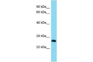 Western Blotting (WB) image for anti-MLLT4 Antisense RNA 1 (Head To Head) (MLLT4-AS1) (Middle Region) antibody (ABIN2791468) (MLLT4-AS1 Antikörper  (Middle Region))
