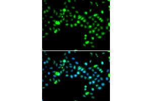 Immunofluorescence analysis of MCF-7 cells using SRSF4 antibody. (SRSF4 Antikörper)