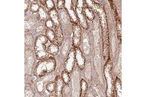Immunohistochemical staining of human kidney with ZNF623 polyclonal antibody  shows distinct cytoplasmic positivity in distal tubules at 1:20-1:50 dilution.